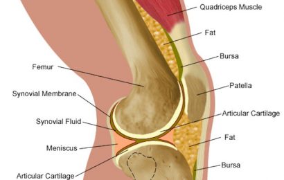 What Is Runner’s Knee? Signs, Symptoms and Rehab Guide